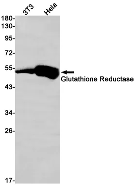 glutathione reductase deficiency  How to assess Vitamin B2 Status? B2 nutritional status is assessed through the ERYTHROCYTE ACTIVITY COEFFICIENT (EGRAC), which should be < 1.2. What is this coefficient? FAD Nineteen-year follow-up of a patient