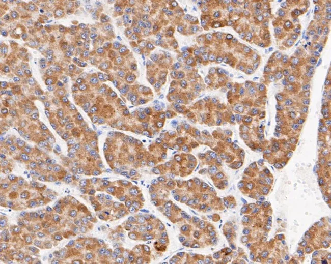 Microsomal Glutathione S-transferase 1 Recombinant Rabbit mAb